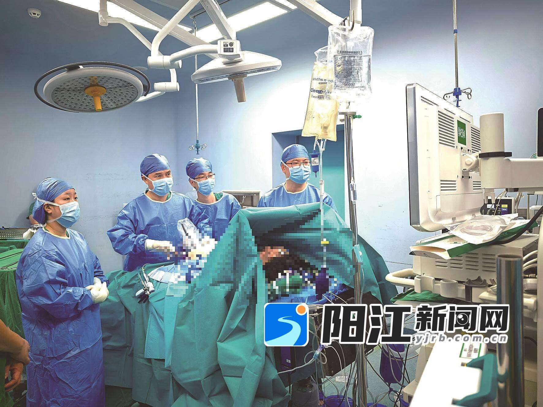 2025年11月,胃肠外科成功为一名肥胖合并代谢综合征患者实施了阳江地区首例腹腔镜袖状胃切除术。